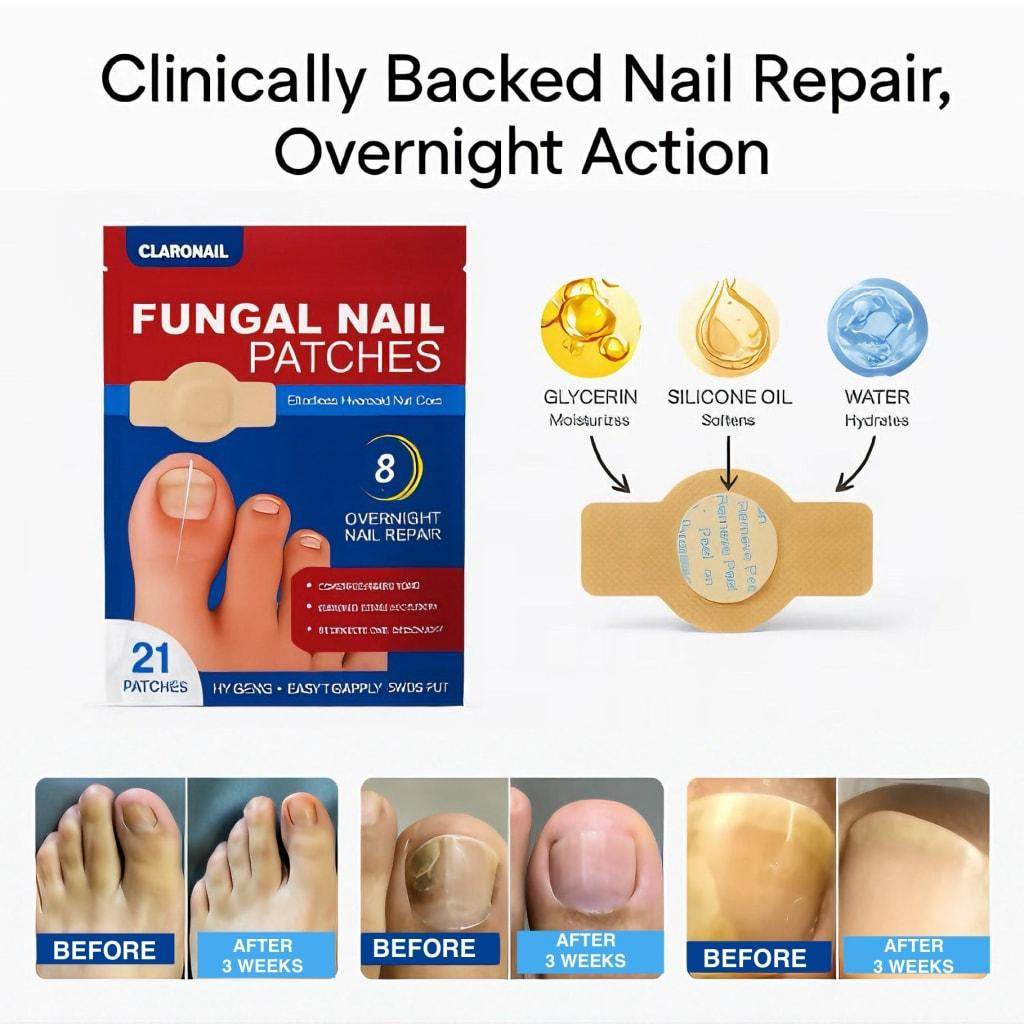 Claronail Fungal Nail Patches